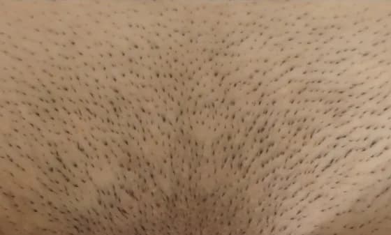 Ile kosztuje depilacja laserowa miejsc intymnych w Warszawie i innych miastach? Ile kosztuje depilacja laserowa miejsc intymnych w Warszawie i innych miastach?