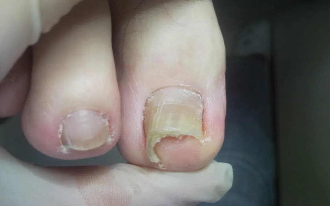 Co grozi za robienie paznokci w domu? Poznaj ryzyka i kary