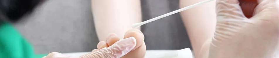 Jak się przygotować do badania mykologicznego paznokci, by uniknąć błędów