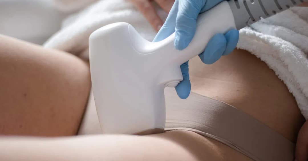 Ile zabiegów depilacji laserowej bikini potrzebujesz dla trwałych efektów?