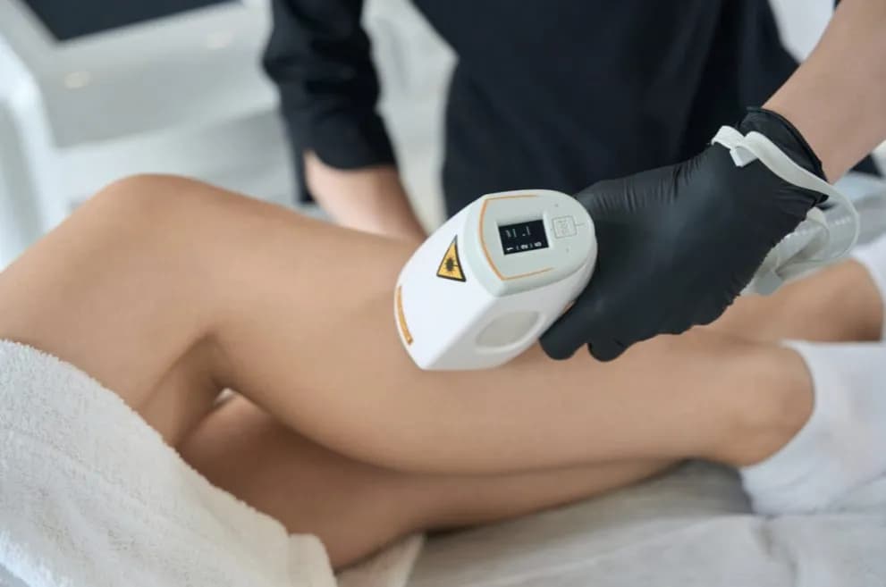 Ile razy trzeba zrobić depilację laserową, aby uzyskać trwałe efekty?