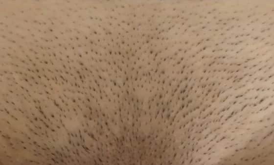 Ile kosztuje depilacja laserowa miejsc intymnych w Warszawie i innych miastach? Ile kosztuje depilacja laserowa miejsc intymnych w Warszawie i innych miastach?