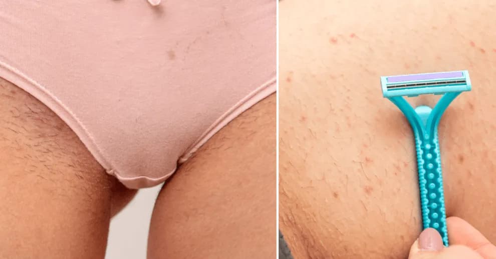 Jak depilować miejsca intymne bez podrażnień i bólu? Sprawdź metody